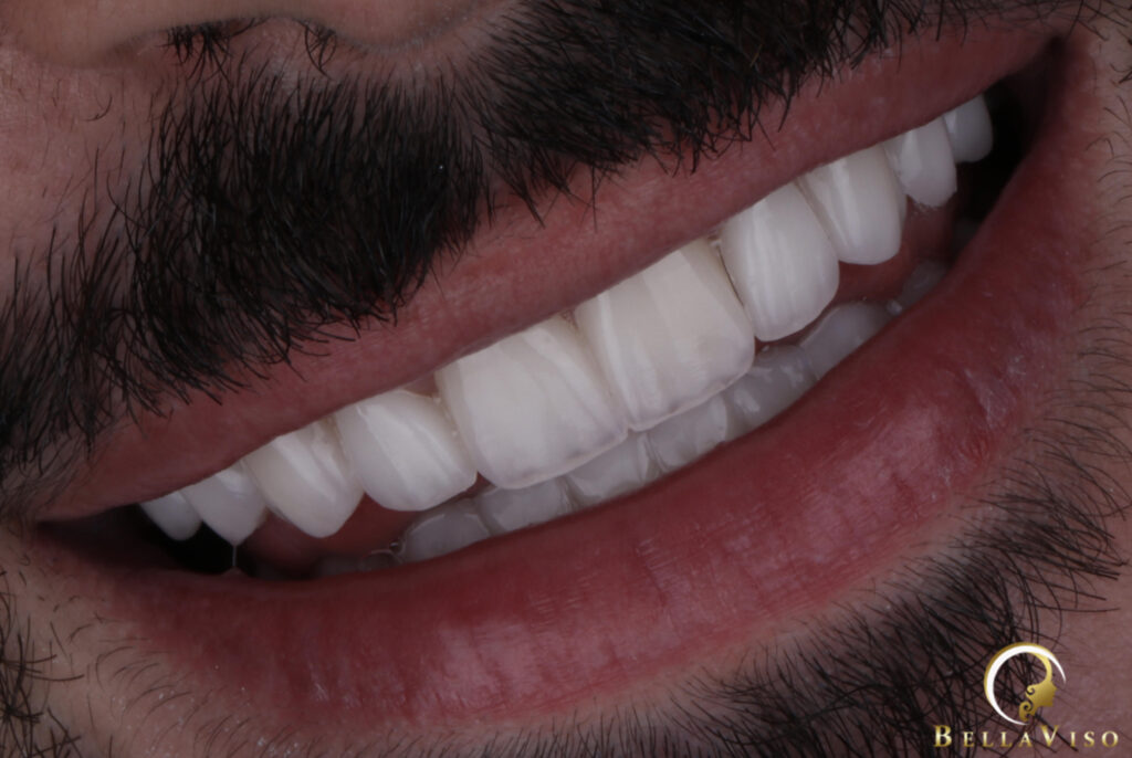 hollywood smile dental clinic dubai,